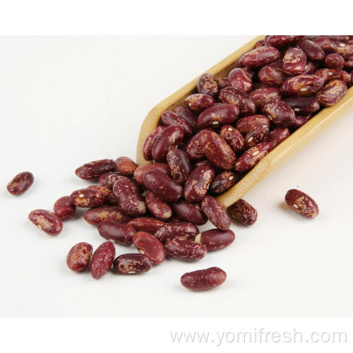 Kidney Beans During Pregnancy